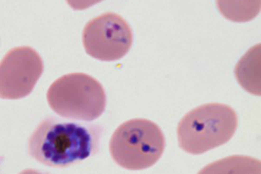malaria parasite cell